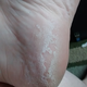 Nasty heelsies!